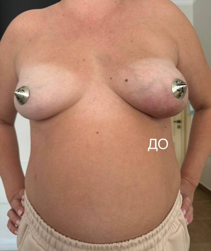 2-5