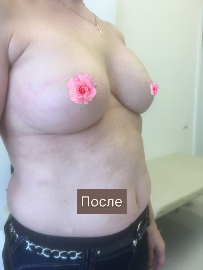 frame-2087326694-7-1